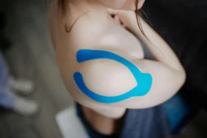 Close-up of a shoulder with blue kinesiology tape applied, addressing common injuries in sports.